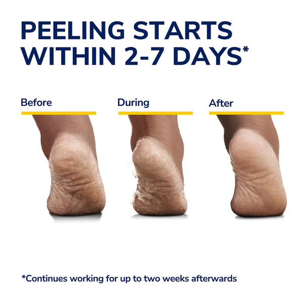 Dr Scholl's Rough Dry Skin Ultra-Exfoliating Foot Mask